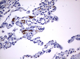 CD30 Antibody - IHC of paraffin-embedded Human lung tissue using anti-TNFRSF8 mouse monoclonal antibody.