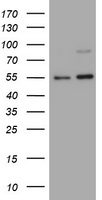 CD30 Antibody - HEK293T cells were transfected with the pCMV6-ENTRY control (Left lane) or pCMV6-ENTRY TNFRSF8 (Right lane) cDNA for 48 hrs and lysed. Equivalent amounts of cell lysates (5 ug per lane) were separated by SDS-PAGE and immunoblotted with anti-TNFRSF8.
