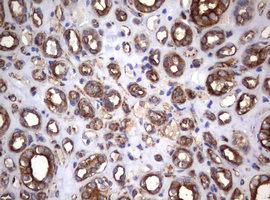 CD30 Antibody - IHC of paraffin-embedded Human Kidney tissue using anti-TNFRSF8 mouse monoclonal antibody.