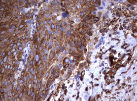 CD30 Antibody - IHC of paraffin-embedded Human Ovary tissue using anti-TNFRSF8 mouse monoclonal antibody.