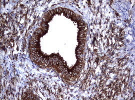 CD30 Antibody - IHC of paraffin-embedded Human endometrium tissue using anti-TNFRSF8 mouse monoclonal antibody.