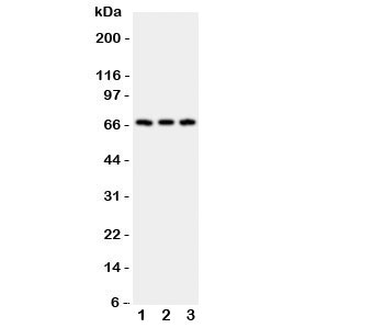 CD30 Antibody - Western blot testing of CD30 antibody and Lane 1: HeLa; 2: 293T; 3: Jurkat; Predicted molecular weight: 53-120 kDa depending on glycosylation level.