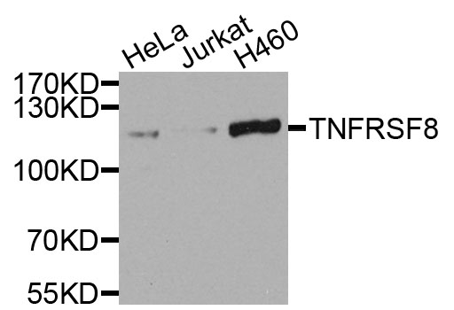 CD30 Antibody - Western blot analysis of extracts of various cells.