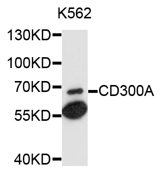 CD300A Antibody - Western blot analysis of extracts of K-562 cells, using CD300A antibody at 1:1000 dilution. The secondary antibody used was an HRP Goat Anti-Rabbit IgG (H+L) at 1:10000 dilution. Lysates were loaded 25ug per lane and 3% nonfat dry milk in TBST was used for blocking. An ECL Kit was used for detection and the exposure time was 90s.