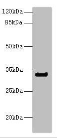 CD300A Antibody - Western blot All Lanes: CNTN4 antibody IgG at 2.22ug/ml+ Mouse kidney tissue Secondary Goat polyclonal to rabbit IgG at 1/10000 dilution Predicted band size: 34,21,12,17 kDa Observed band size: 33 kDa