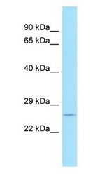 CD300C Antibody - CD300c antibody Western Blot of 721_B.  This image was taken for the unconjugated form of this product. Other forms have not been tested.