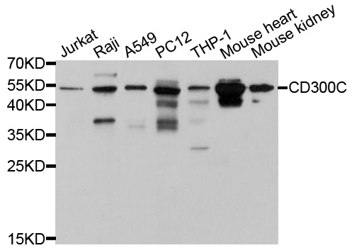 CD300C Antibody - Western blot analysis of extracts of various cell lines, using CD300C antibody at 1:1000 dilution. The secondary antibody used was an HRP Goat Anti-Rabbit IgG (H+L) at 1:10000 dilution. Lysates were loaded 25ug per lane and 3% nonfat dry milk in TBST was used for blocking. An ECL Kit was used for detection and the exposure time was 30s.