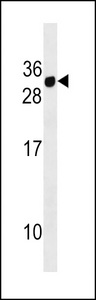 CD300E Antibody - CD300E Antibody western blot of MDA-MB453 cell line lysates (35 ug/lane). The CD300E antibody detected the CD300E protein (arrow).