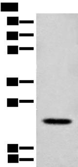 CD300E Antibody - Western blot analysis of Mouse lung tissue lysate  using CD300E Polyclonal Antibody at dilution of 1:550