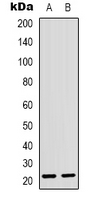 CD300LD Antibody - Western blot analysis of CD300d expression in U2OS (A); NIH3T3 (B) whole cell lysates.