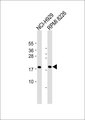 CD300LD Antibody - All lanes: Anti-CD300d Antibody at 1:1000 dilution. Lane 1: NCI-H929 whole cell lysate. Lane 2: RPMI 8226 whole cell lysate Lysates/proteins at 20 ug per lane. Secondary Goat Anti-Rabbit IgG, (H+L), Peroxidase conjugated at 1:10000 dilution. Predicted band size: 22 kDa. Blocking/Dilution buffer: 5% NFDM/TBST.