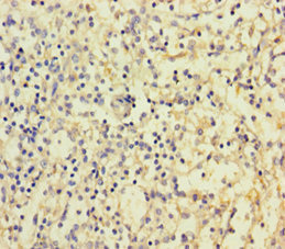 CD300LF / CD300f Antibody - Immunohistochemistry of paraffin-embedded human spleen tissue using CD300LF Antibody at dilution of 1:100