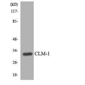 CD300LF / CD300f Antibody - Western blot analysis of the lysates from HepG2 cells using CLM-1 antibody.