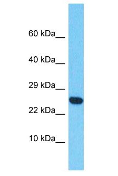 CD300LF / CD300f Antibody - CD300f antibody Western Blot of HepG2. Antibody dilution: 1 ug/ml.  This image was taken for the unconjugated form of this product. Other forms have not been tested.