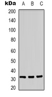 CD300LF / CD300f Antibody - Western blot analysis of CD300f expression in A431 (A); Jurkat (B); PC12 (C) whole cell lysates.
