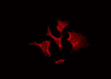 CD300LF / CD300f Antibody - Staining HeLa cells by IF/ICC. The samples were fixed with PFA and permeabilized in 0.1% Triton X-100, then blocked in 10% serum for 45 min at 25°C. The primary antibody was diluted at 1:200 and incubated with the sample for 1 hour at 37°C. An Alexa Fluor 594 conjugated goat anti-rabbit IgG (H+L) Ab, diluted at 1/600, was used as the secondary antibody.
