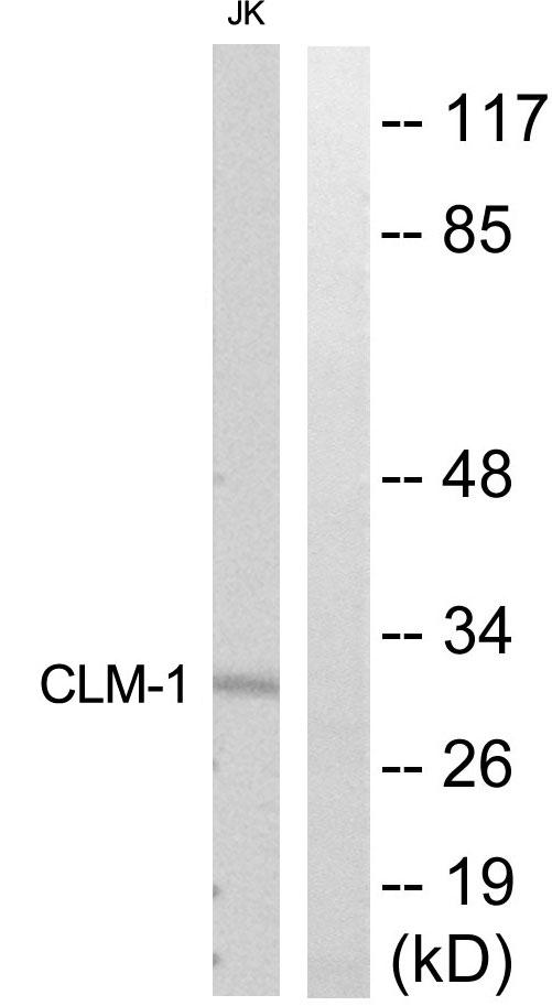 CD300LF / CD300f Antibody - Western blot analysis of extracts from Jurkat cells, using CLM-1 antibody.