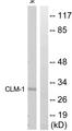 CD300LF / CD300f Antibody - Western blot analysis of extracts from Jurkat cells, using CLM-1 antibody.