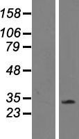 CD300LF / CD300f Protein - Western validation with an anti-DDK antibody * L: Control HEK293 lysate R: Over-expression lysate