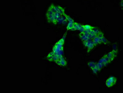 CD300LG Antibody - Immunofluorescence staining of 293 cells at a dilution of 1:66, counter-stained with DAPI. The cells were fixed in 4% formaldehyde, permeabilized using 0.2% Triton X-100 and blocked in 10% normal Goat Serum. The cells were then incubated with the antibody overnight at 4 °C.The secondary antibody was Alexa Fluor 488-congugated AffiniPure Goat Anti-Rabbit IgG (H+L) .