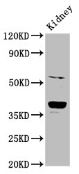 CD300LG Antibody - Positive Western Blot detected in Rat kidney tissue. All lanes: CD300LG antibody at 6 µg/ml Secondary Goat polyclonal to rabbit IgG at 1/50000 dilution. Predicted band size: 37, 27, 25, 34, 30 KDa. Observed band size: 37 KDa