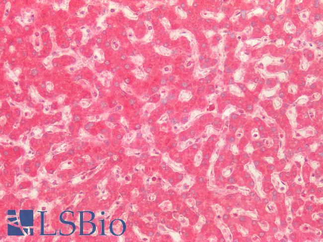 CD302 Antibody - Human Liver: Formalin-Fixed, Paraffin-Embedded (FFPE)