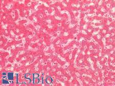 CD302 Antibody - Human Liver: Formalin-Fixed, Paraffin-Embedded (FFPE)