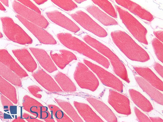 CD302 Antibody - Human Skeletal Muscle: Formalin-Fixed, Paraffin-Embedded (FFPE)