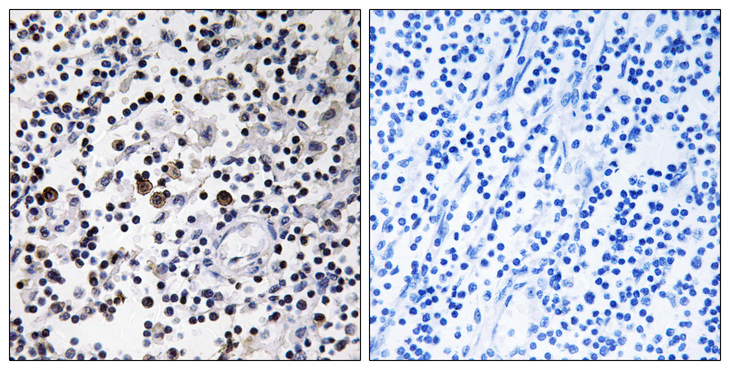CD302 Antibody - Immunohistochemistry analysis of paraffin-embedded human lymph node tissue, using CD302 Antibody. The picture on the right is blocked with the synthesized peptide.