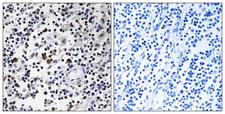 CD302 Antibody - Immunohistochemistry analysis of paraffin-embedded human lymph node tissue, using CD302 Antibody. The picture on the right is blocked with the synthesized peptide.