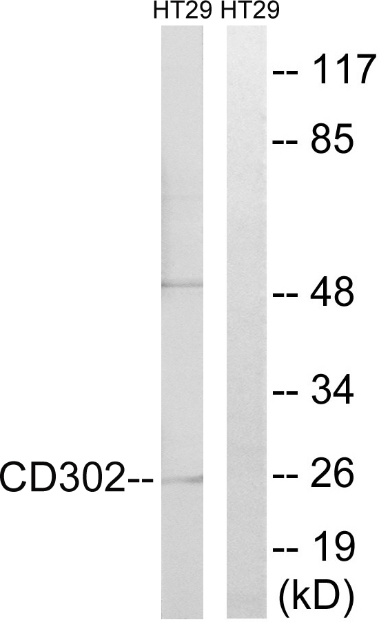 CD302 Antibody - Western blot analysis of lysates from HT-29 cells, using CD302 Antibody. The lane on the right is blocked with the synthesized peptide.