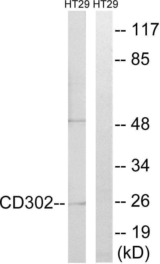 CD302 Antibody - Western blot analysis of extracts from HT-29 cells, using CD302 antibody.