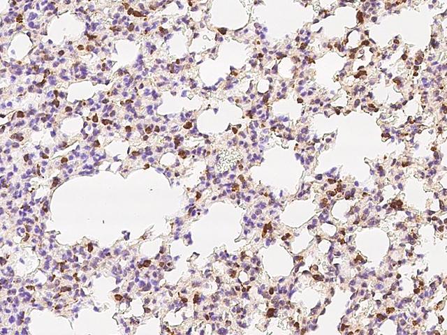CD302 Antibody - Immunochemical staining of mouse CD302 in mouse lung with rabbit polyclonal antibody at 1:1000 dilution, formalin-fixed paraffin embedded sections.