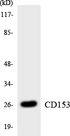 CD30L / CD153 Antibody - Western blot analysis of the lysates from K562 cells using CD153 antibody.