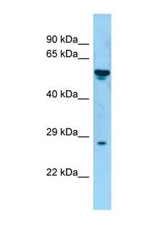 CD30L / CD153 Antibody - TNFSF8 antibody Western blot of Fetal Kidney lysate. Antibody concentration 1 ug/ml.  This image was taken for the unconjugated form of this product. Other forms have not been tested.