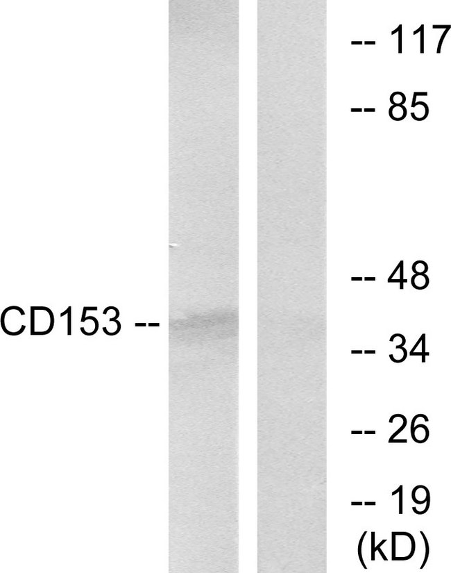 CD30L / CD153 Antibody - Western blot analysis of lysates from RAW264.7 cells, using CD153 Antibody. The lane on the right is blocked with the synthesized peptide.