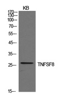 CD30L / CD153 Antibody - Western Blot analysis of extracts from KB cells using TNFSF8 Antibody.