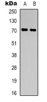 CD316 / IGSF8 Antibody - Western blot analysis of CD316 expression in K562 (A); NIH3T3 (B) whole cell lysates.