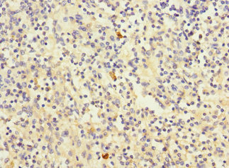 CD320 Antibody - Immunohistochemistry of paraffin-embedded human spleen tissue at dilution 1:100