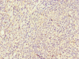 CD320 Antibody - Immunohistochemistry of paraffin-embedded human tonsil tissue at dilution 1:100