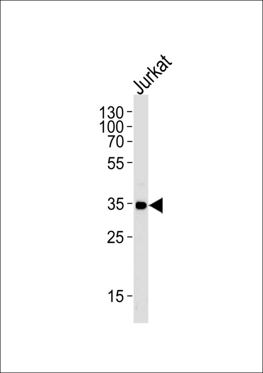 CD32A Antibody - Western blot of lysate from Jurkat cell line,using FCGR2A Antibody. Antibody was diluted at 1:1000 at each lane. A goat anti-rabbit IgG H&L (HRP) at 1:5000 dilution was used as the secondary antibody.Lysate at 35ug per lane.