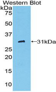 CD32A Antibody - Western blot of recombinant FCGR2A / CD32A.  This image was taken for the unconjugated form of this product. Other forms have not been tested.