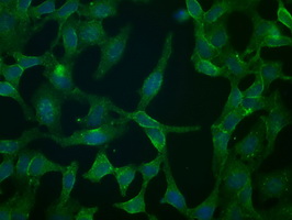 CD32A Antibody - Immunofluorescent staining of HeLa cells using anti-FCGR2A mouse monoclonal antibody.