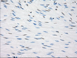CD32A Antibody - IHC of paraffin-embedded colon tissue using anti-FCGR2A mouse monoclonal antibody. (Dilution 1:50).