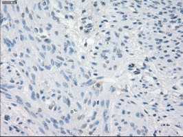 CD32A Antibody - IHC of paraffin-embedded endometrium tissue using anti-FCGR2A mouse monoclonal antibody. (Dilution 1:50).