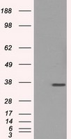 CD32A Antibody - HEK293T cells were transfected with the pCMV6-ENTRY control (Left lane) or pCMV6-ENTRY FCGR2A (Right lane) cDNA for 48 hrs and lysed. Equivalent amounts of cell lysates (5 ug per lane) were separated by SDS-PAGE and immunoblotted with anti-FCGR2A.