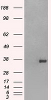 CD32A Antibody - HEK293T cells were transfected with the pCMV6-ENTRY control (Left lane) or pCMV6-ENTRY FCGR2A (Right lane) cDNA for 48 hrs and lysed. Equivalent amounts of cell lysates (5 ug per lane) were separated by SDS-PAGE and immunoblotted with anti-FCGR2A.