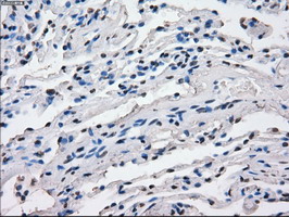 CD32A Antibody - IHC of paraffin-embedded lung tissue using anti-FCGR2A mouse monoclonal antibody. (Dilution 1:50).