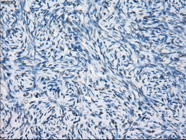 CD32A Antibody - IHC of paraffin-embedded Ovary tissue using anti-FCGR2A mouse monoclonal antibody. (Dilution 1:50).