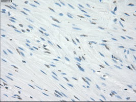 CD32A Antibody - IHC of paraffin-embedded colon tissue using anti-FCGR2A mouse monoclonal antibody. (Dilution 1:50).